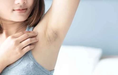Underarm Skin Lightening Treatment in Mumbai