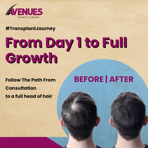 besthairtransplantresults.jfif