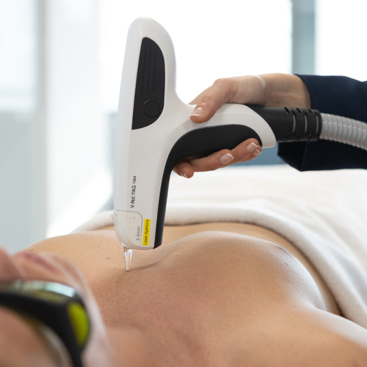 V30 V-NdYAG treatment square