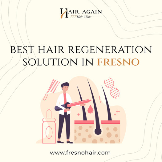besthairregenerationsolutioninfresno.jpg