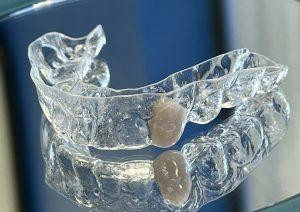 essixretainer2300x212.jpg