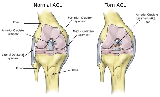 A First-Hand Look at ACL Treatment in Bangalore Doctor Near Me ACL Treatment in bengalore