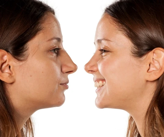 Rhinoplasty Surgeon in Mumbai
