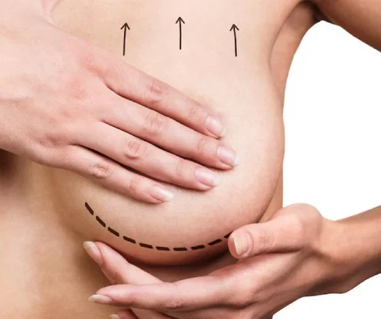 Breast Lift Surgery in Mumbai | Dr. Devayani Barve – Expert Cosmetic Surgeon for Natural Results Doctor Near Me Breast lift surgery in Mumbai