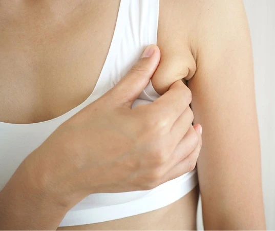 Armpit Fat Removal in Mumbai