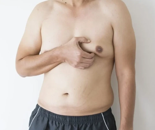 Gynecomastia Surgery in Mumbai