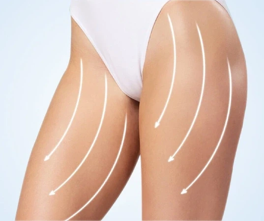 Thigh Lift Surgery in Mumbai
