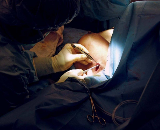 Breast lift in mumbai