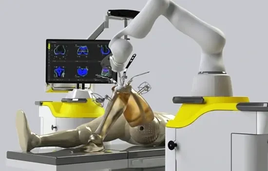 Robotic Knee Replacement Surgery in Bangalore
