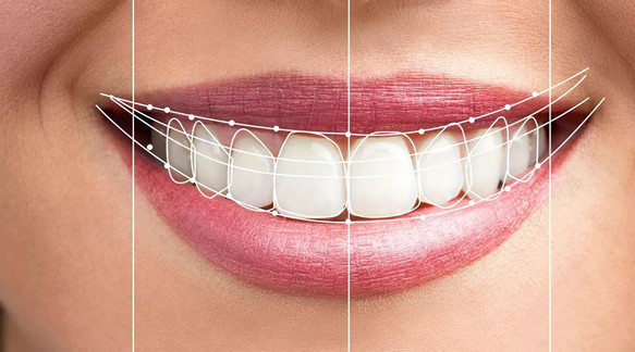 teethalignertreatmentinpaschimvihar.jpg