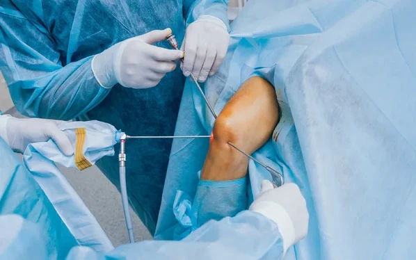 Knee Surgery Arthroscopy in Dubai, UAE | Dr. Azam Badar Khan – Expert Orthopedic Surgeon Doctor Near Me Knee Surgery Arthroscopy in Dubai, UAE