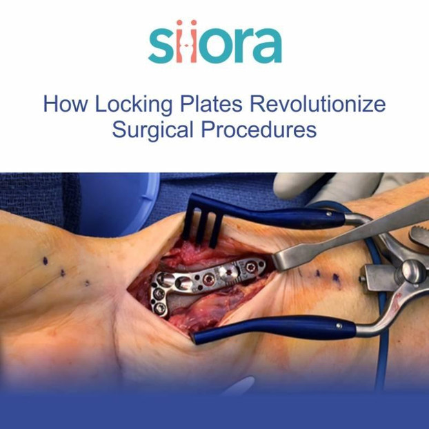 How Locking Plates Revolutionize Surgical Procedures