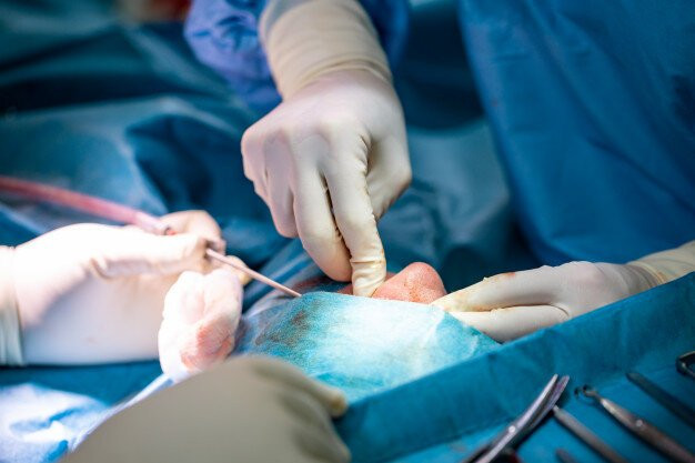 Rhinoplasty Surgeon in Mumbai