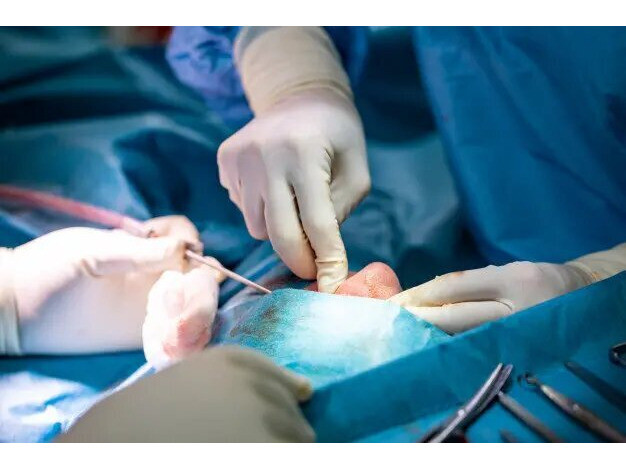 Best Rhinoplasty Surgeon in Mumbai