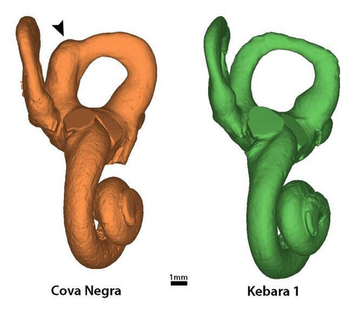 En orange, vue en trois dimensions de l’oreille interne du fossile de l’enfant néandertalien de Cova Negra (Espagne), montrant une dilatation pathologique d’un canal semi-circulaire. A droite, l’oreille interne d’un Néandertalien ne souffrant pas de cette pathologie.