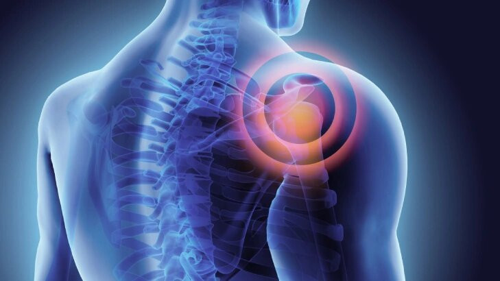 Frozen Shoulder Treatment in Bangalore