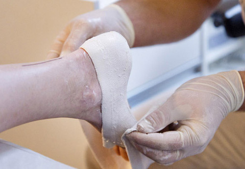 A Specialist creating custom orthotics for a client, providing professional orthotic services in Adelaide.
