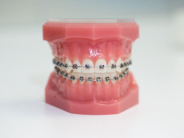 orthodontistcostforbraces.jpg