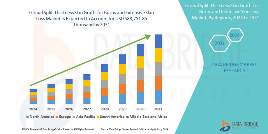 splitthicknessskingraftsforburnsandextensiveskinlossmarket.jpg