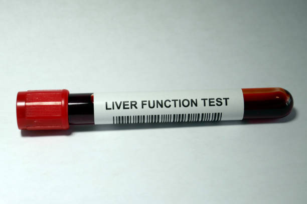liverfunctiontest.jpg