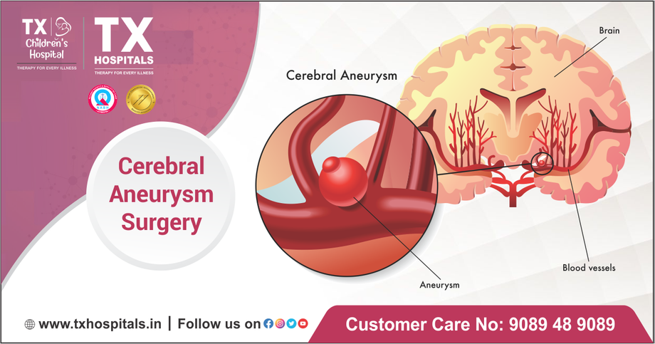 cerebralaneurysmsugery.png
