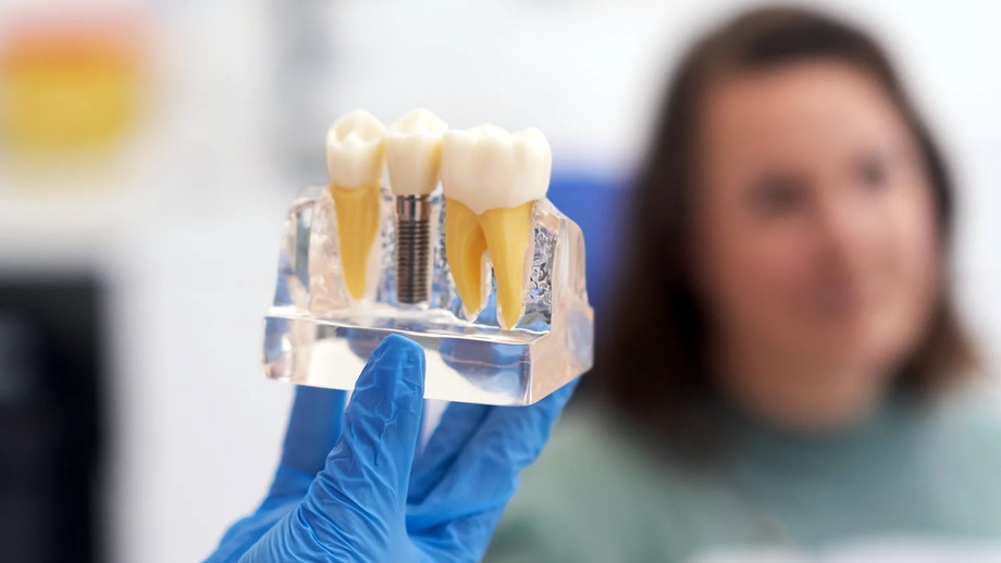 imgi_4_dentalimplants.jpeg