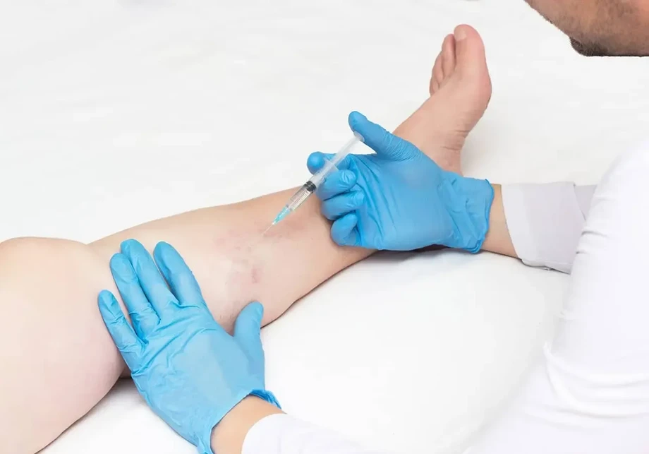 imageye____imgi_69_veintreatmentnyc_1.webp