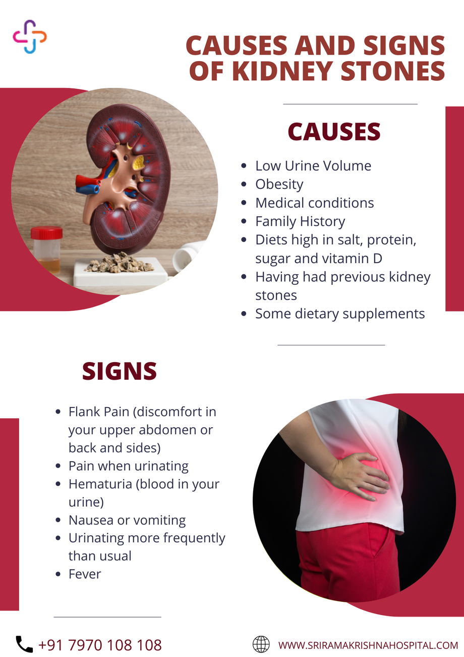 causesandsignsofkidneystones.png