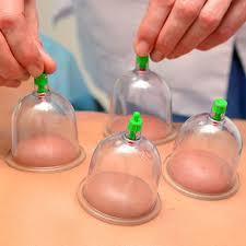 What are the Benefits of Hijama Treatment in Chennai and Cupping Therapy in Chennai?