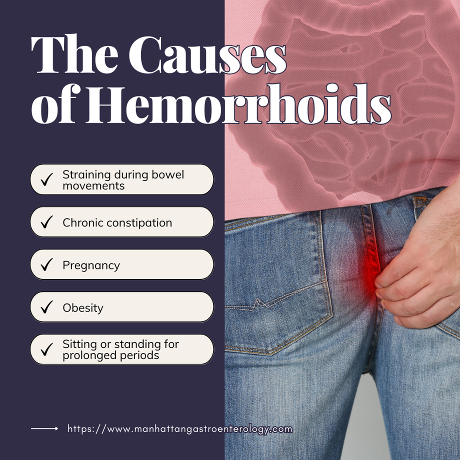 thecausesofhemorrhoids.png