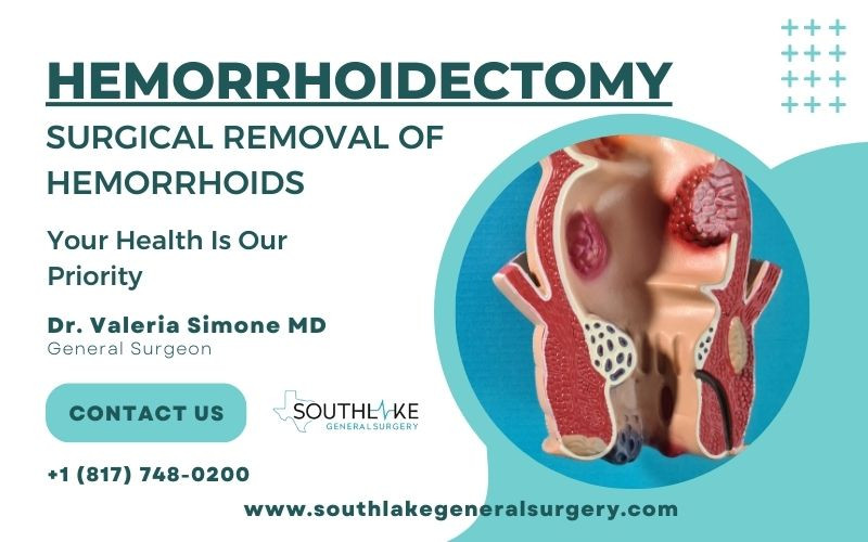 hemorrhoidectomysurgicalremovalofhemorrhoids.jpg