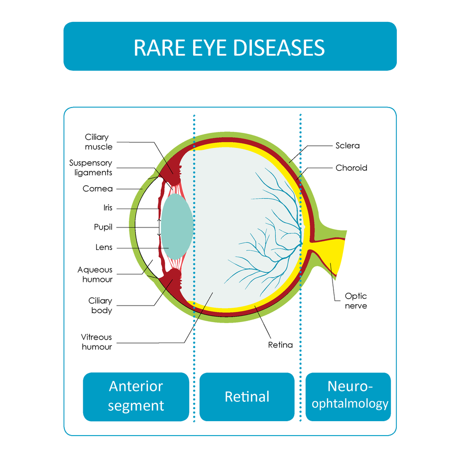 rare_eye_diseases.png