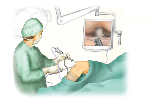 arthroscopysurgery1.jpg