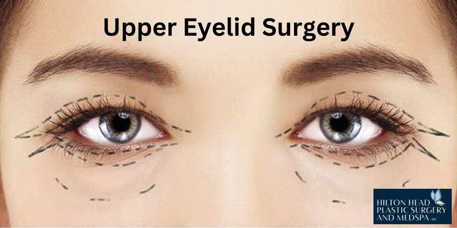 uppereyelidsurgery.jpg