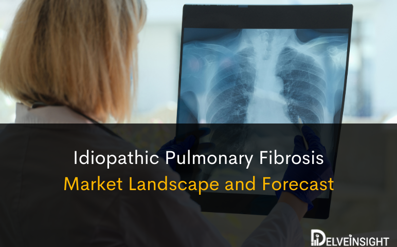idiopathicpulmonaryfibrosismarketlandscapeandforecast.png