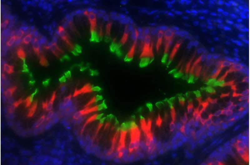 primaryciliarydyskinesia.jpg
