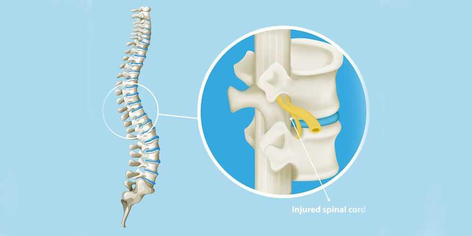 craniospinaltrauma.jpg