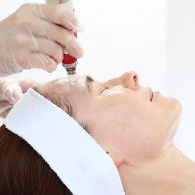 mesotreatmentforface_1_.jpg