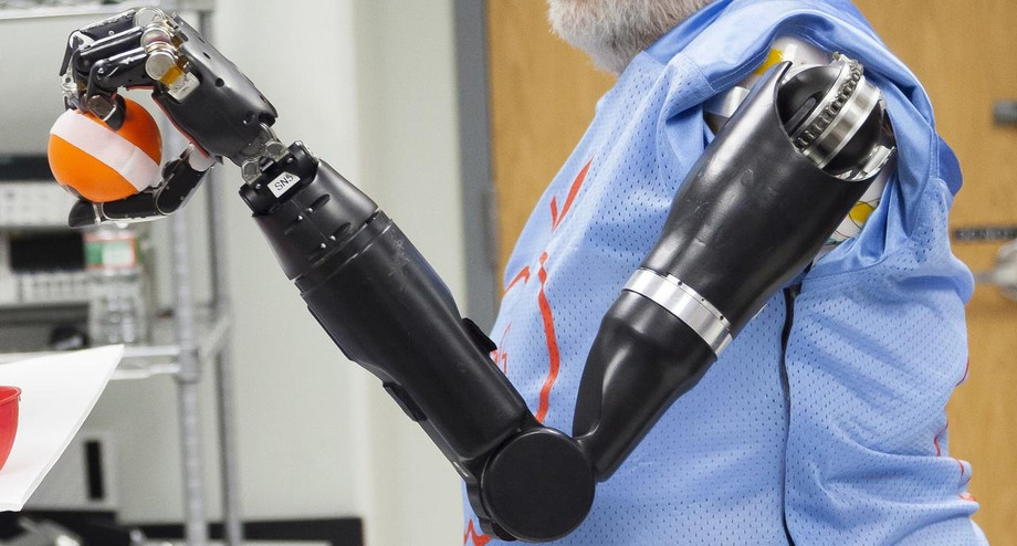 globalroboticprosthetics.jpg
