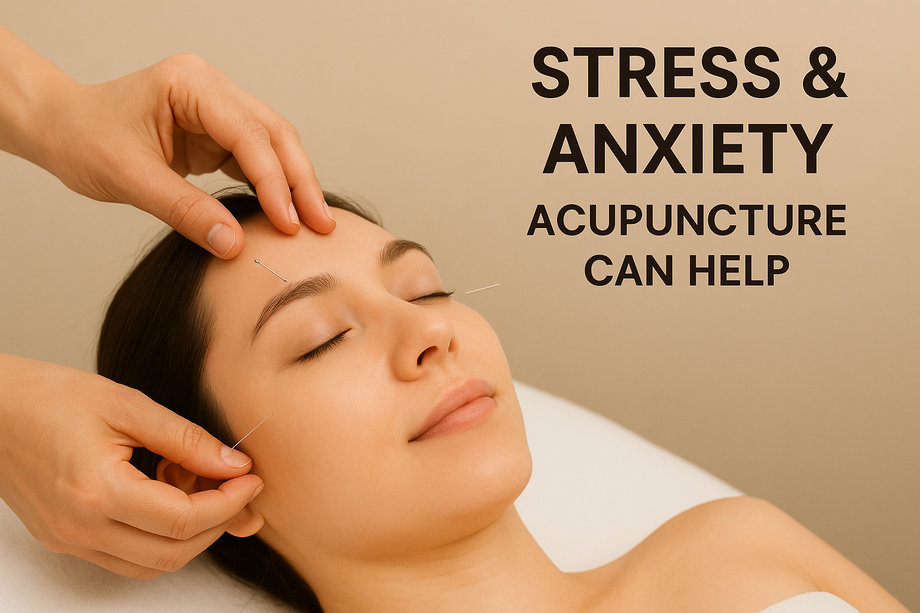 acupunctureforstressrelief.png
