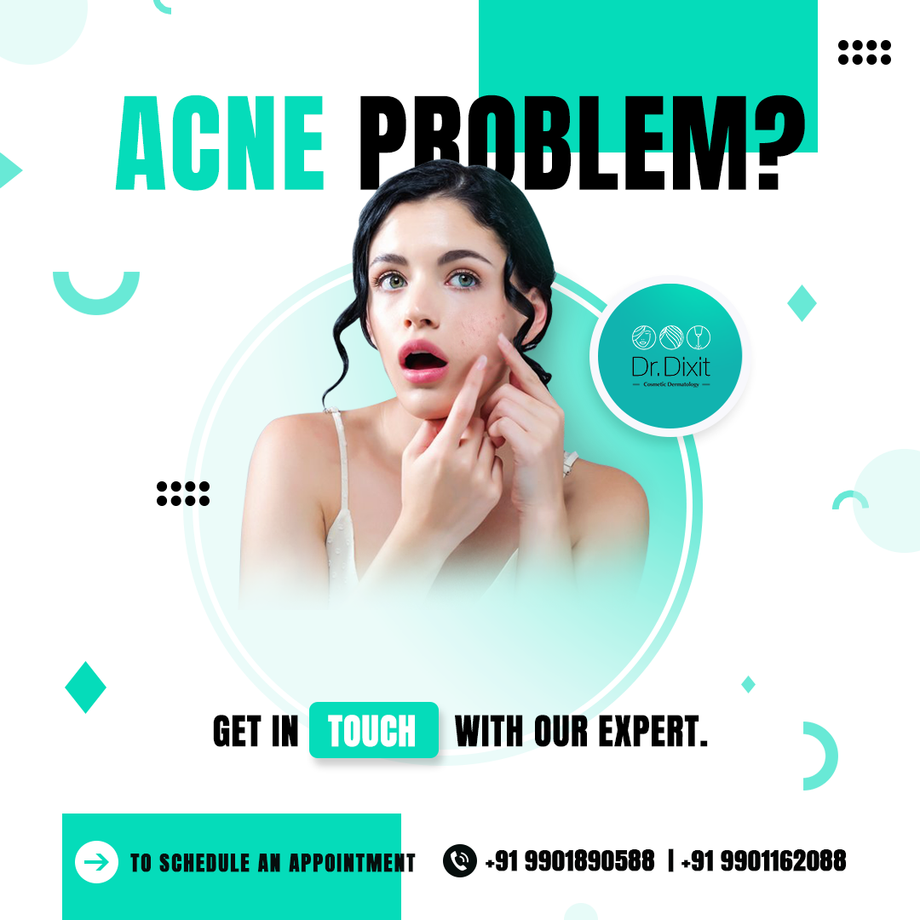 acnescartreatmentinbangalore.png