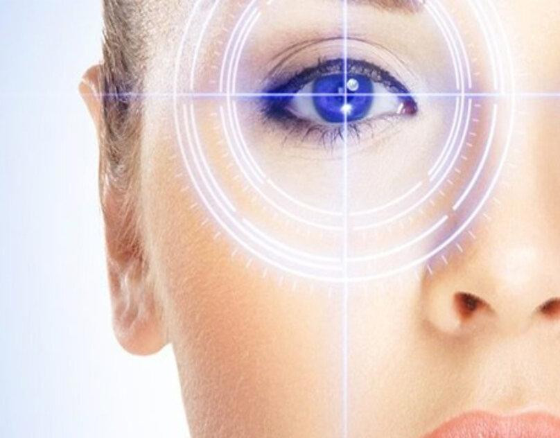 lasik1.jpg