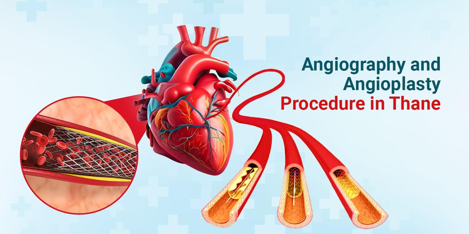 angiographyandangioplastyprocedureinthane.jpg