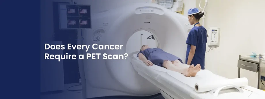 doeseverycancerrequireapetscan_1.webp