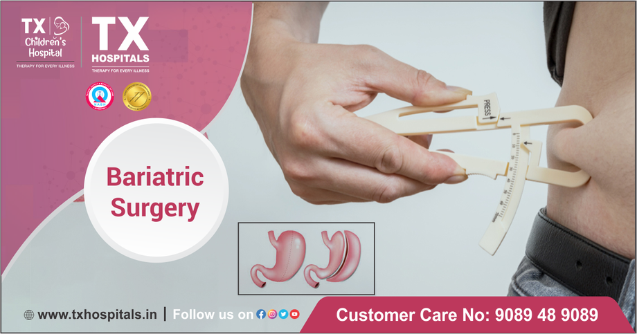 bariatricsurgery2.png