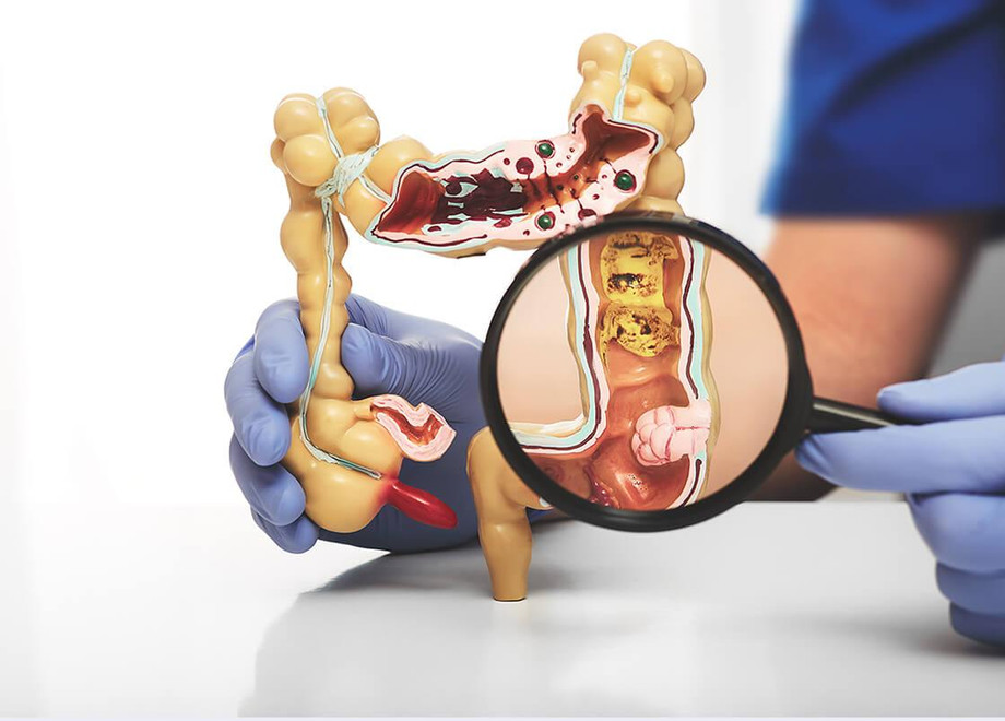 colorectalsurgeryheader.jpg