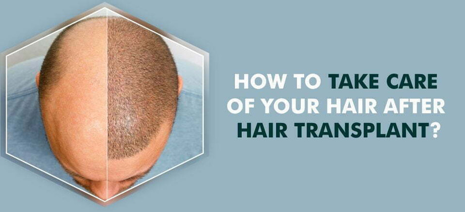 howtotakecareofyourhairafterhairtransplant.jpg