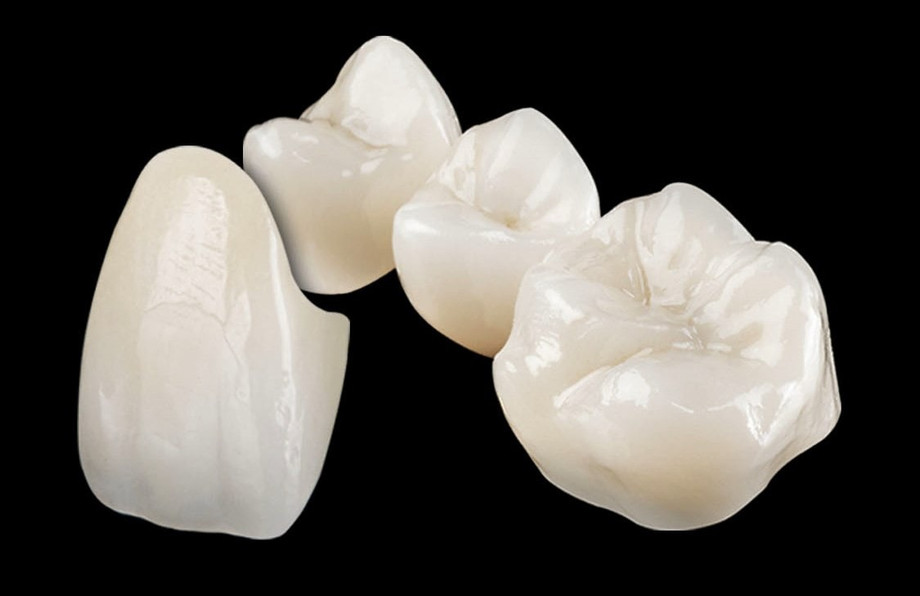 zirconia_restorations.jpg