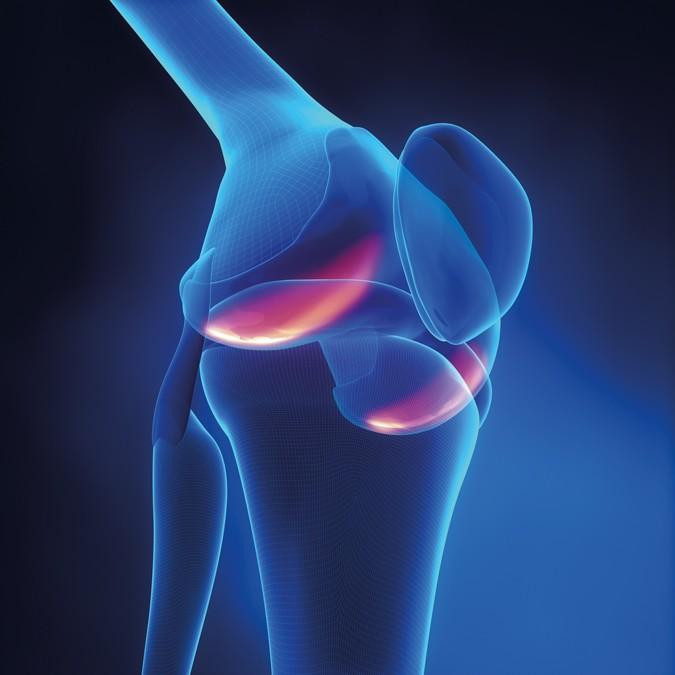 kneeosteoarthritismarket.jpg