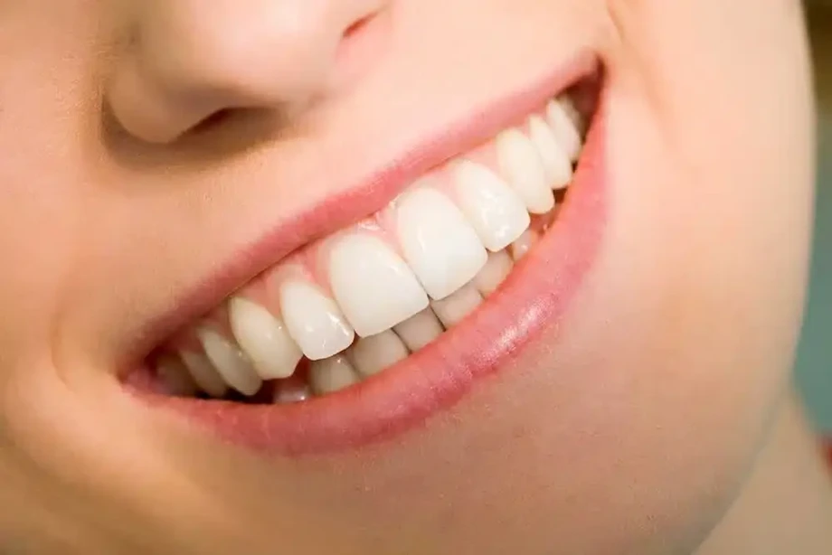16.webp